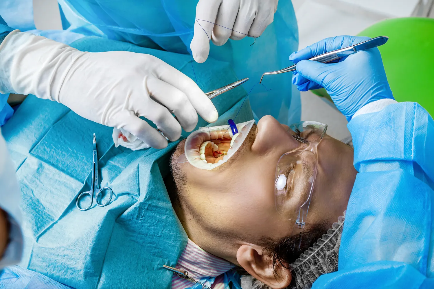 Implanty jarzmowe co to?