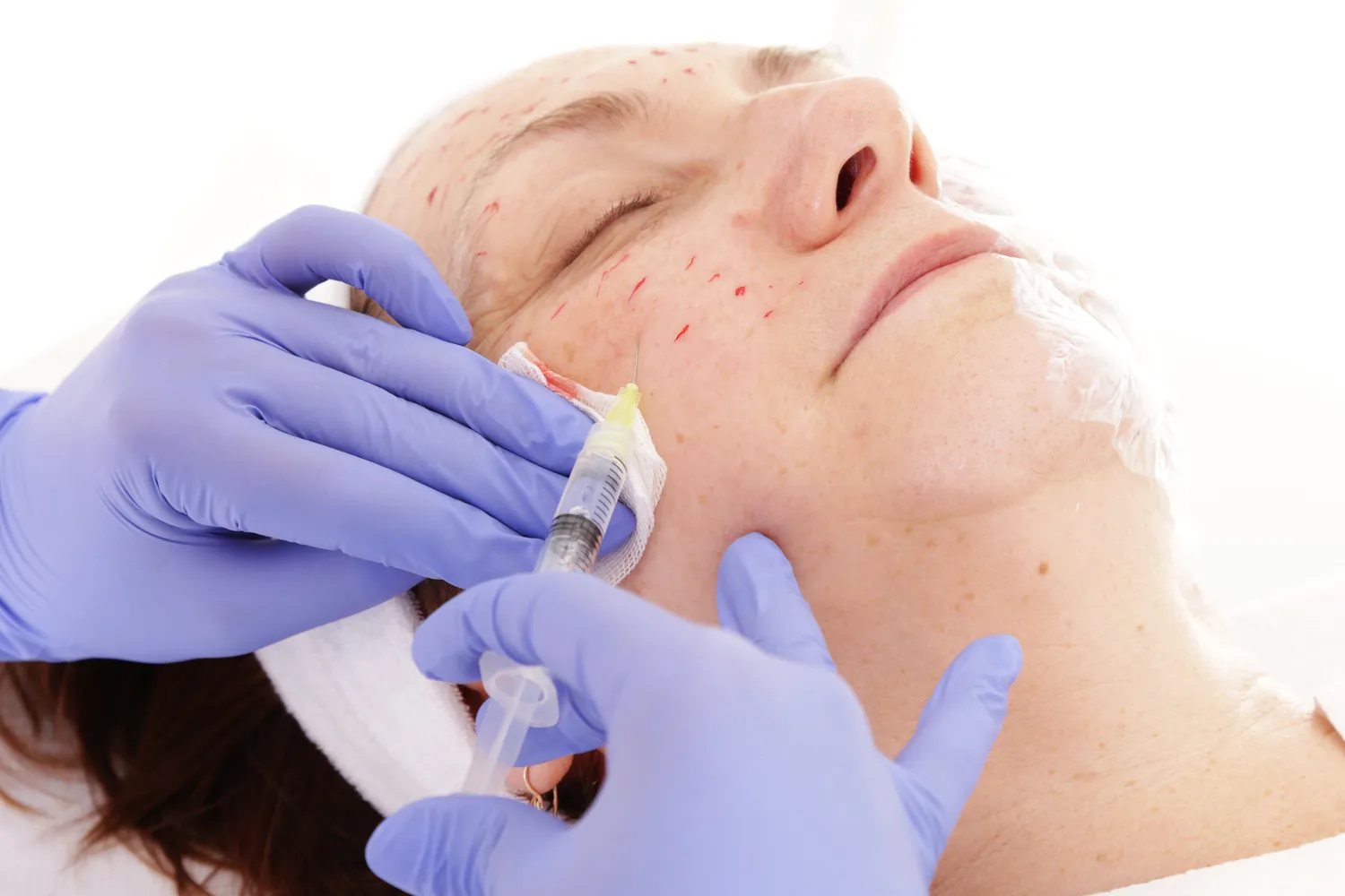 Medycyna estetyczna kto może wykonywać zabiegi?