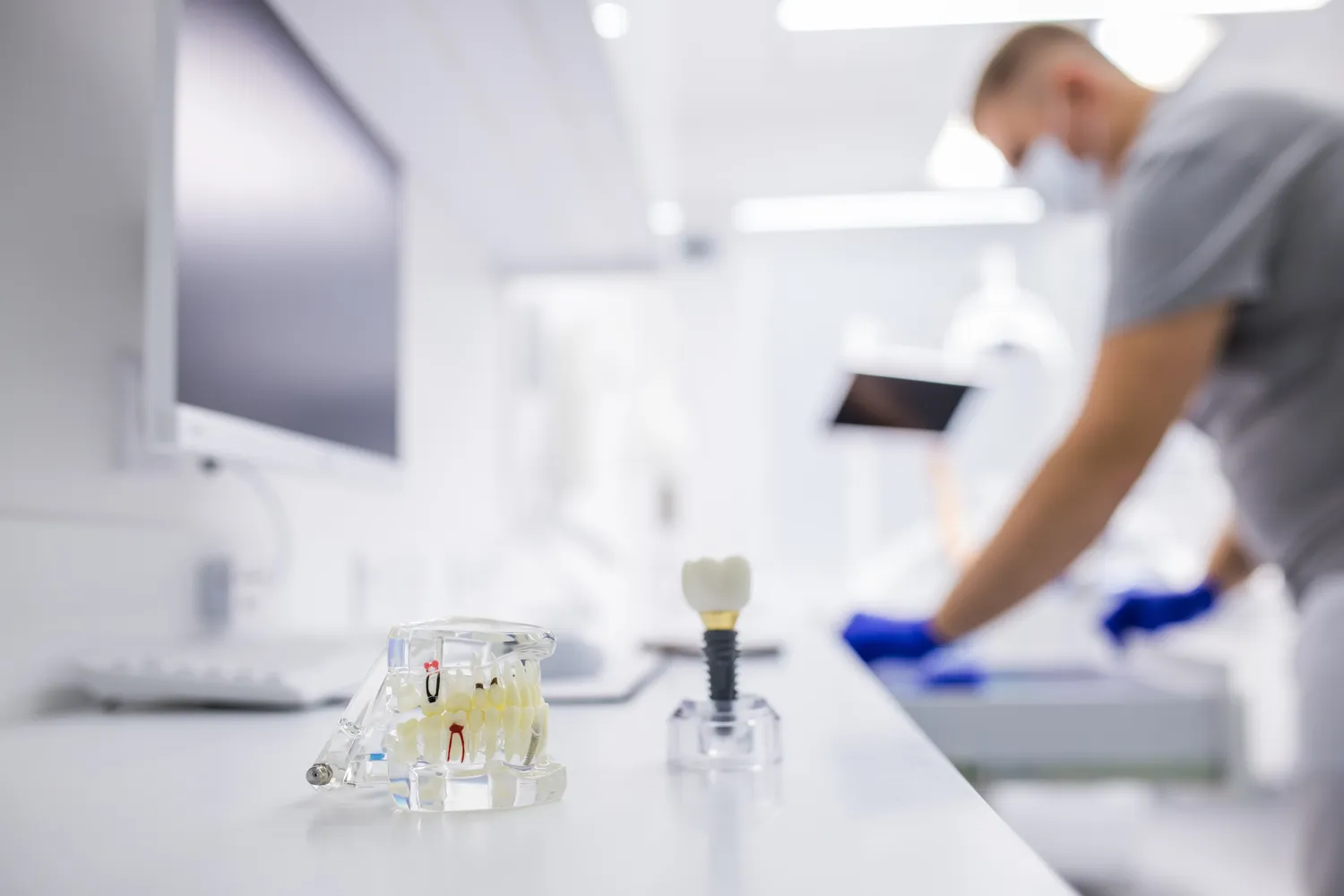 Ile kosztuje implanty zębów?